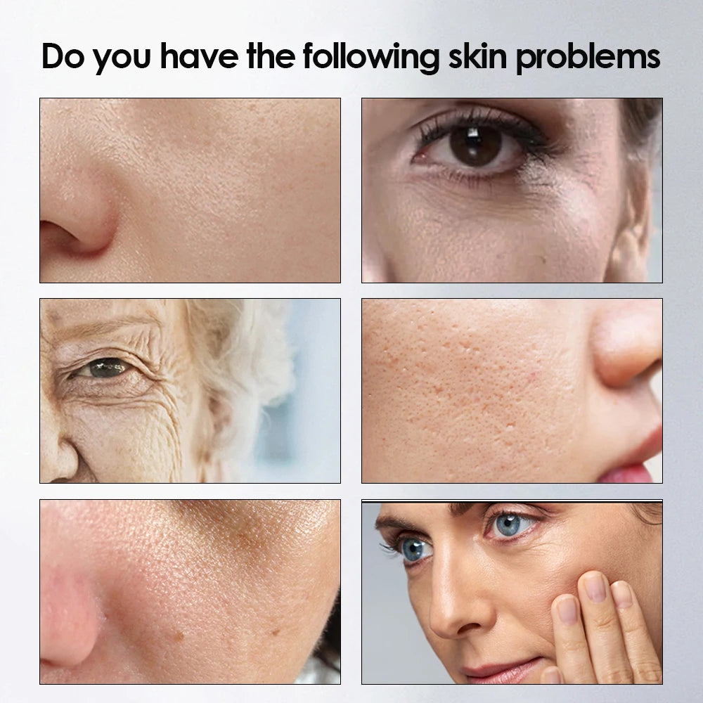 Hyaluronic Face Moisturizer Moisturizing snail Cream Anti-Wrinkle Aging Moisturizing Shrink Pores Whitening Smooth Skin Care