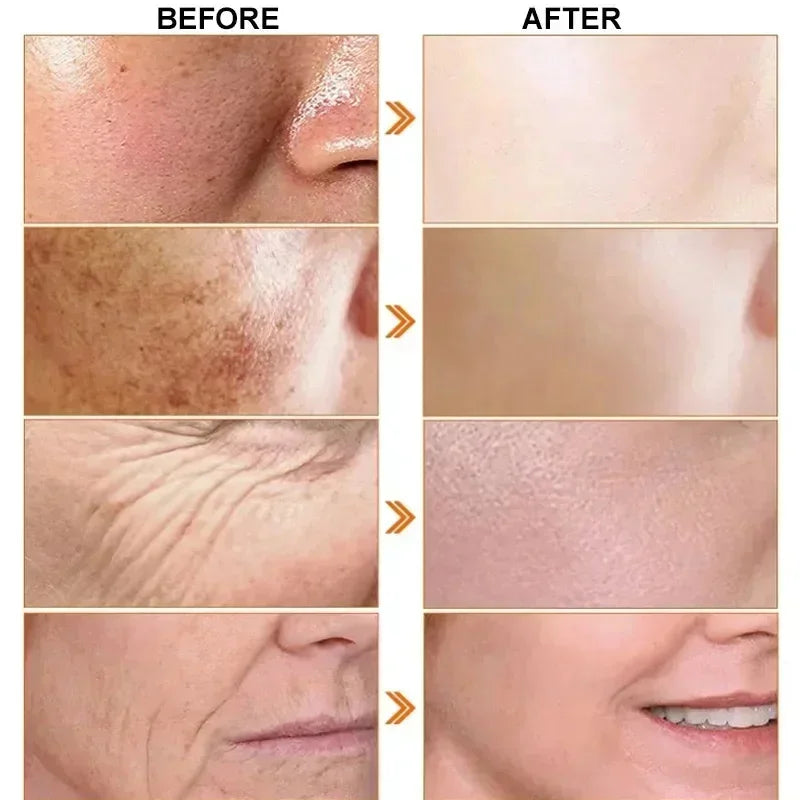 Japan Sakura Wrinkle Remover Face Serum Cream Anti-Aging Fade Fine Lines Lift Firming Vitamin C Whitening Rejuvenation Skin Care