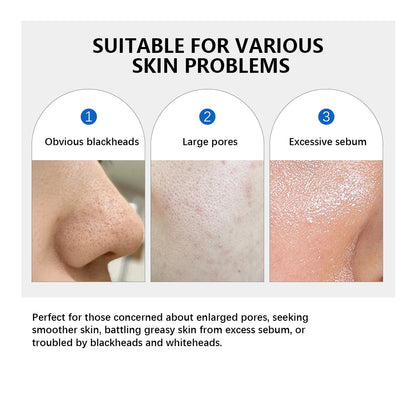 4.5% AHA Lactic Acid & 0.45% BHA 0-pore Toner Pad Salicylic Acid Dual-Textured Facial Toner Pads for Exfoliation and Pore Care